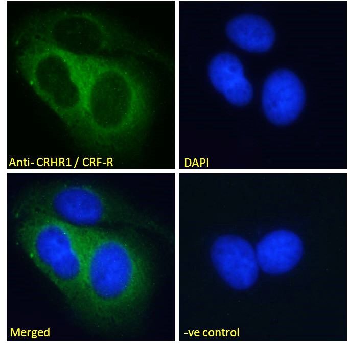 Goat anti-CRHR1 / CRF-R (aa 250 - 263) Antibody