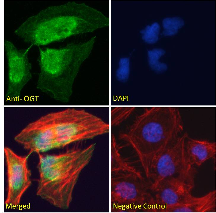 Goat anti-OGT Antibody