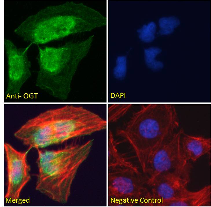 OGT antibody