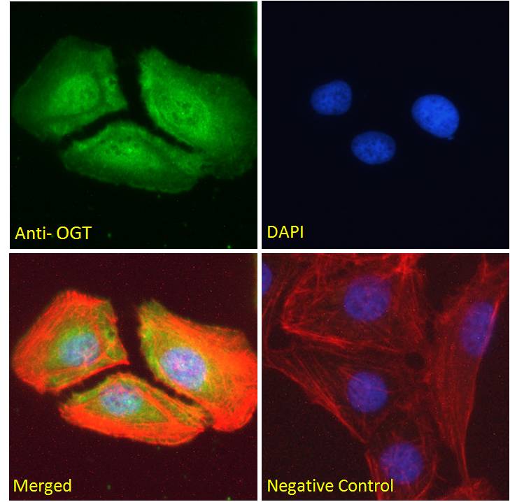 Goat anti-OGT Antibody