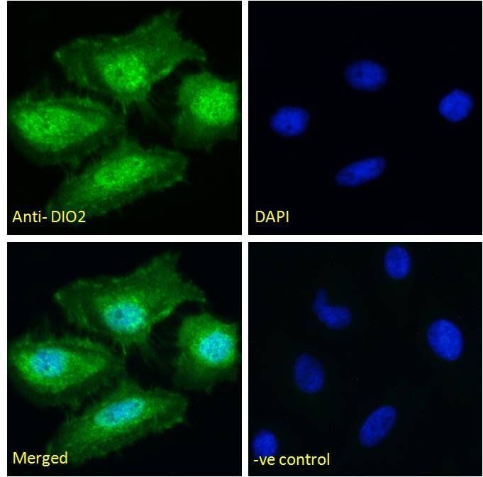 Goat anti-DIO2 Antibody
