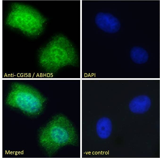 Goat anti-CGI58 / ABHD5 Antibody