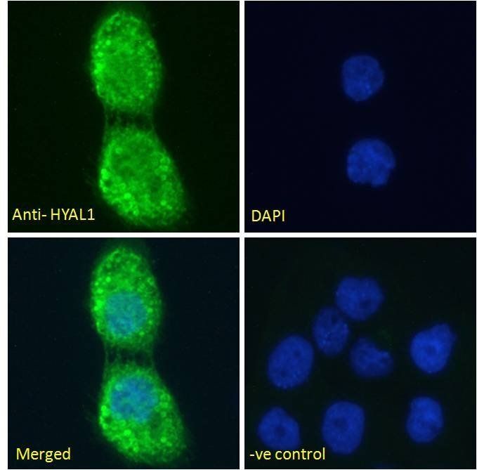 Goat anti-Hyaluronidase 1 Antibody