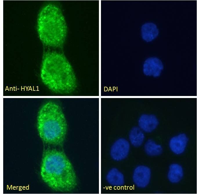 HYAL1 antibody