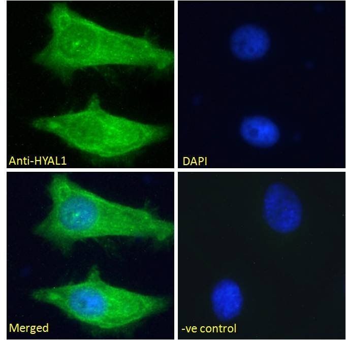 Goat anti-Hyaluronidase 1 Antibody