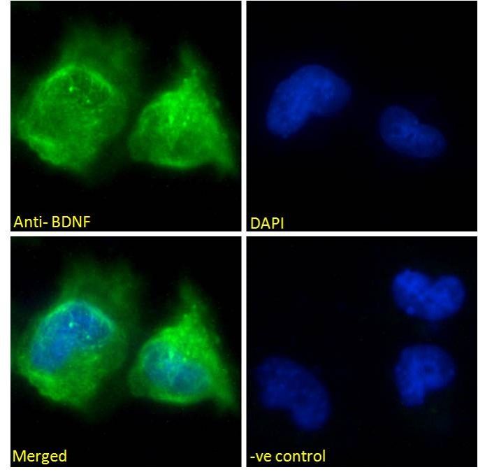Goat anti-BDNF Antibody