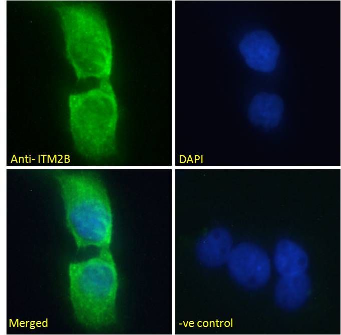 Goat anti-ITM2B Antibody