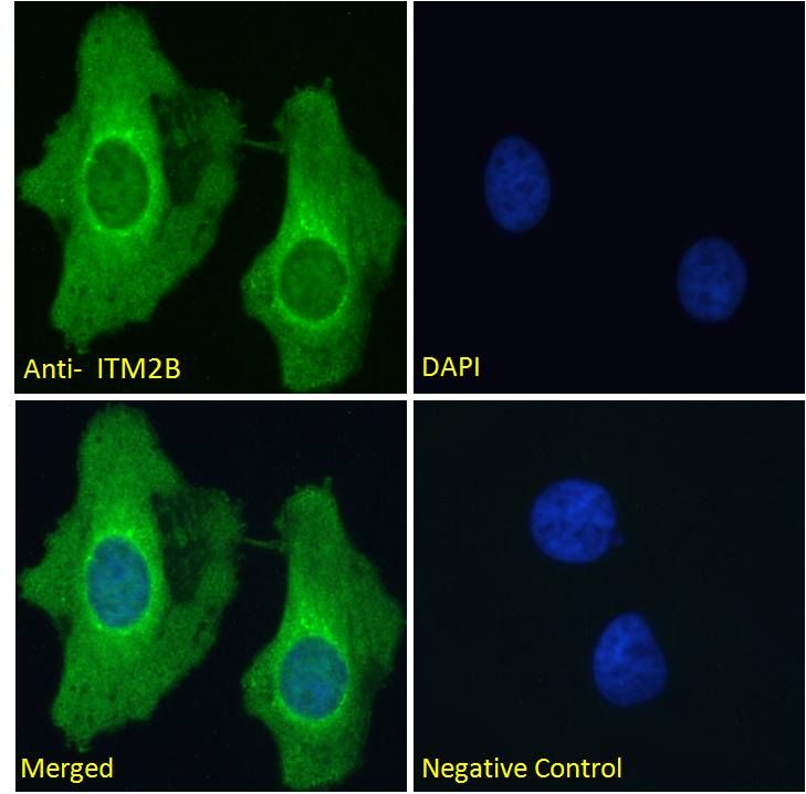 Goat anti-ITM2B Antibody