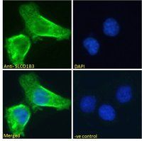 Goat anti-SLCO1B3 Antibody