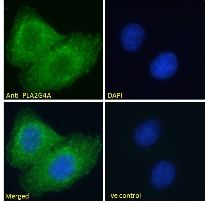 Goat anti-PLA2G4A Antibody
