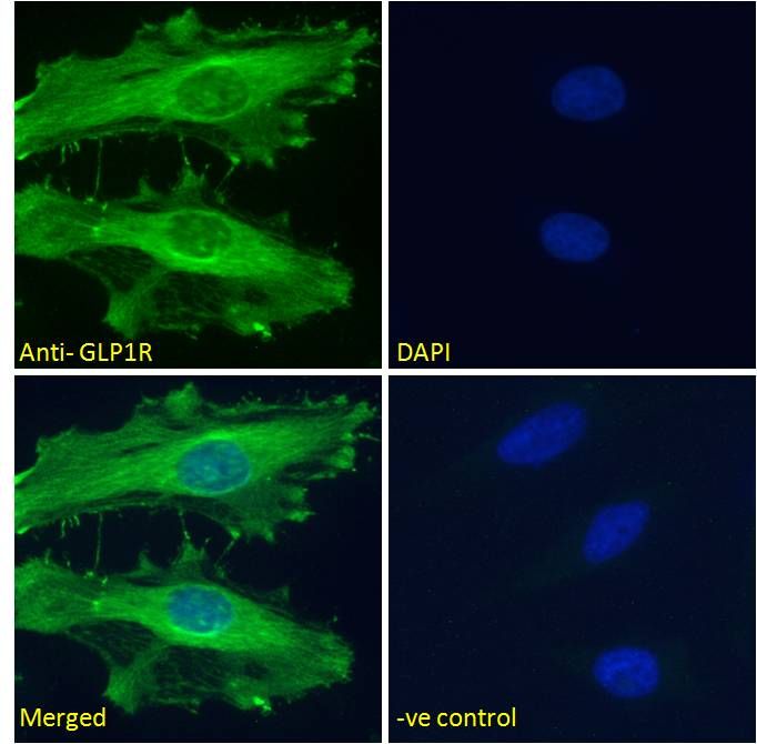 Goat anti-GLP1R Antibody