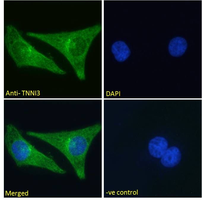 Goat anti-TNNI3 (aa117-127) Antibody