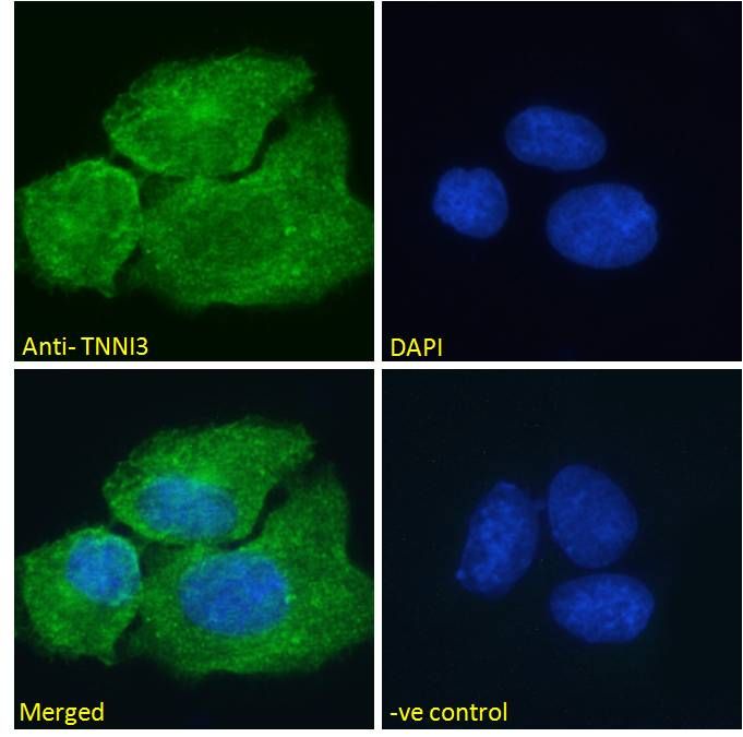 Goat anti-TNNI3 (aa117-127) Antibody