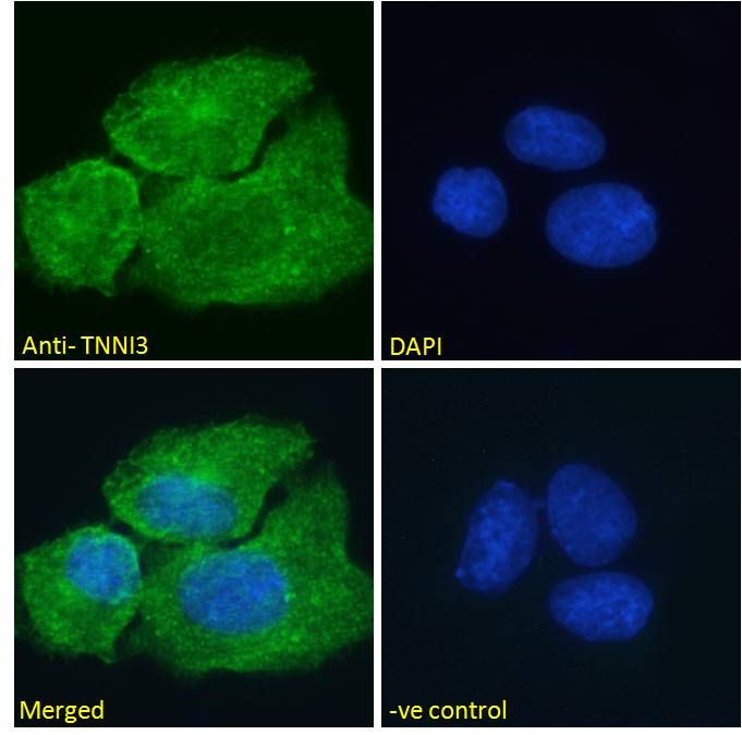 TNNI3 antibody