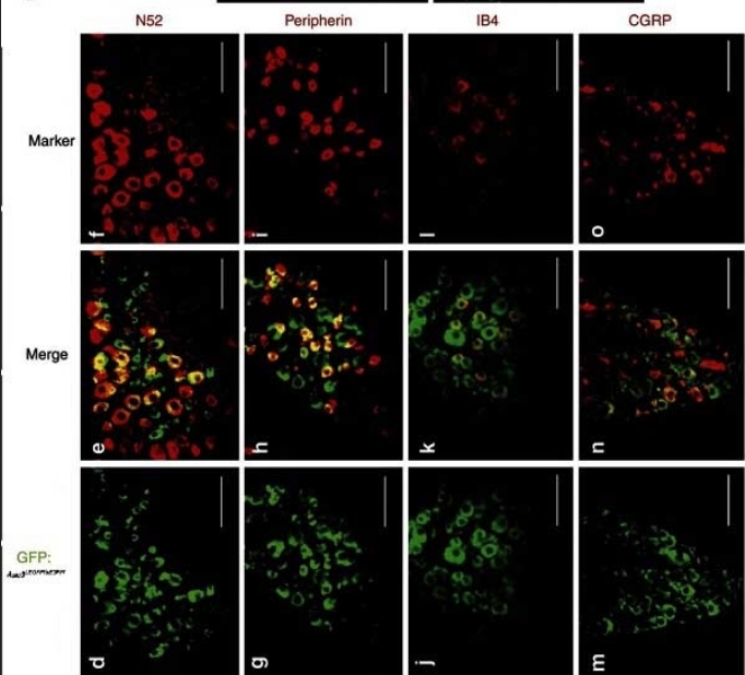 CGRP antibody