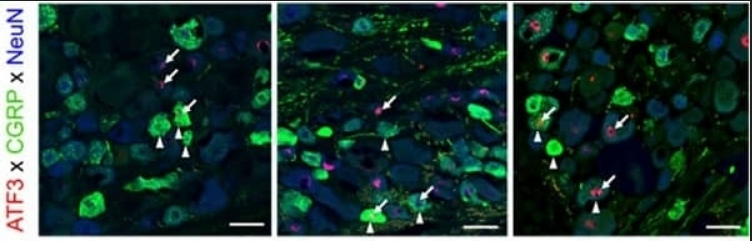 CGRP antibody