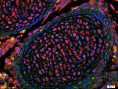 KLF2 Rabbit Polyclonal Antibody (PE)