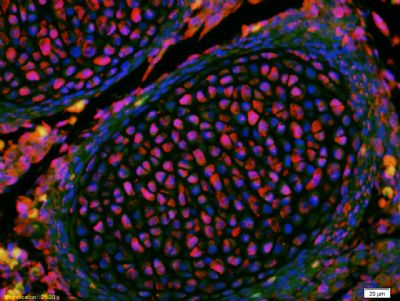 KLF2 antibody (PE)