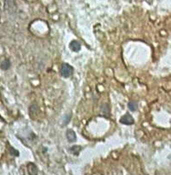 IFI44 Rabbit Polyclonal Antibody