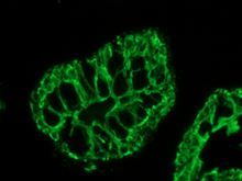 Mouse anti Cytokeratin 20
