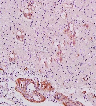 IFITM1 Rabbit Polyclonal Antibody