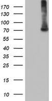 IFIT1 Antibody