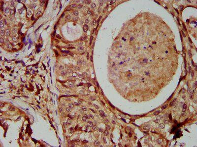IFIT2 Antibody