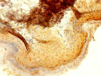 IFIT5 Antibody