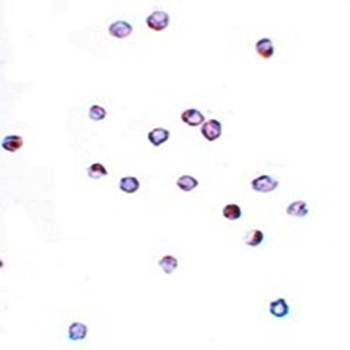 IFITM1 Antibody