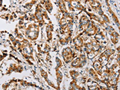 IFITM3 antibody