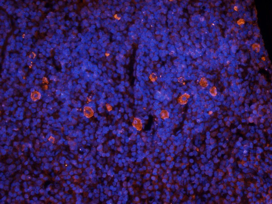 IFN alpha antibody