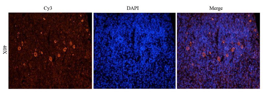 IFN alpha antibody