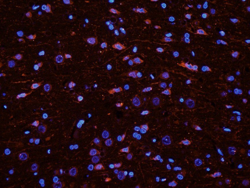 IFN alpha antibody