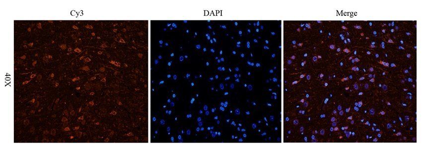 IFN alpha antibody