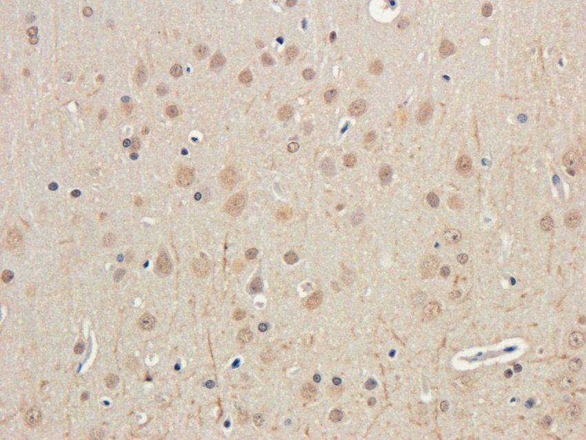 IFN alpha antibody