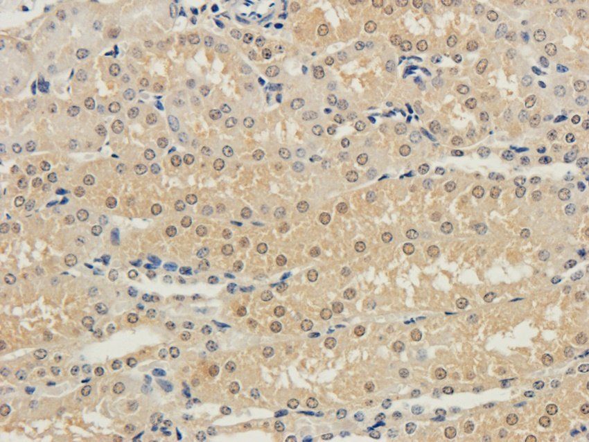 IFN alpha antibody