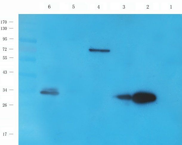 IFN alpha antibody