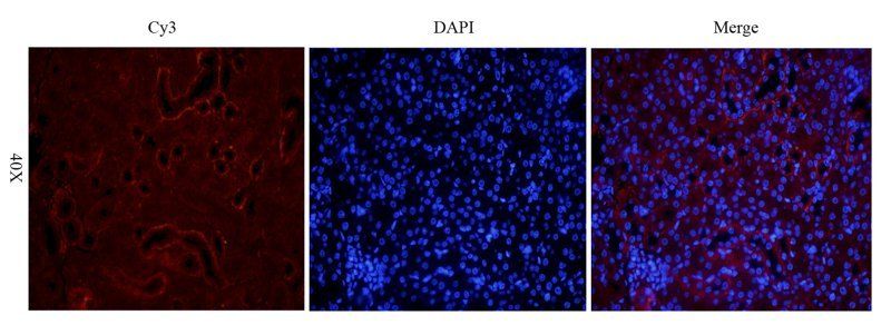 Interferon gamma antibody