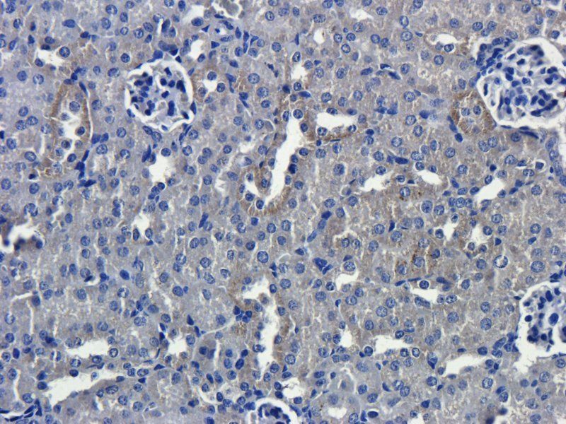 Interferon gamma antibody