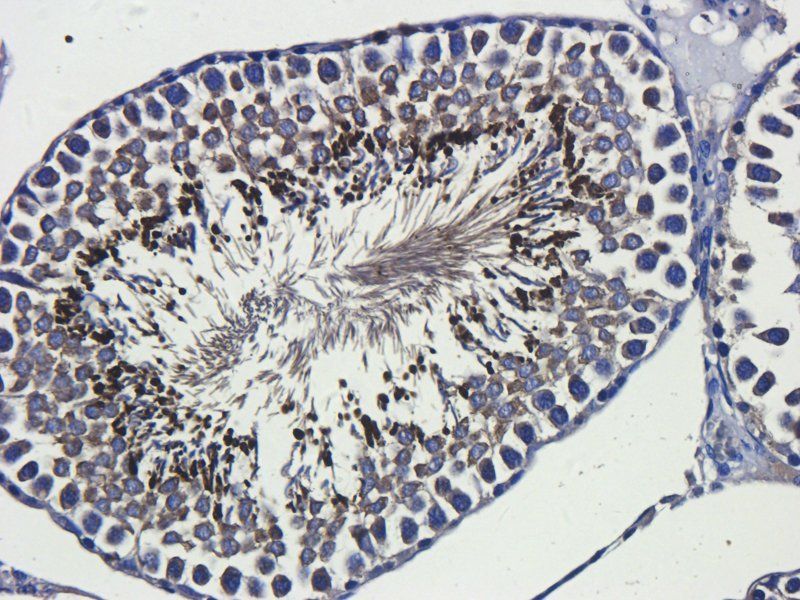 Interferon gamma antibody