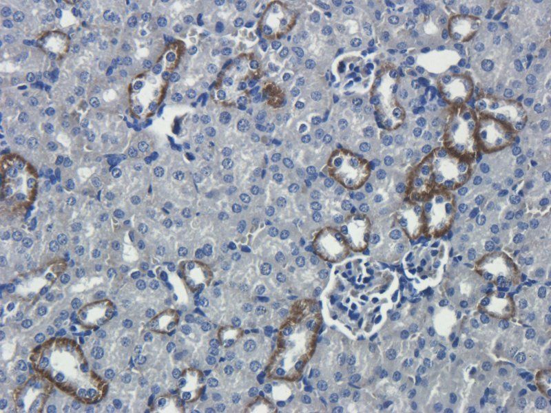 Interferon gamma antibody