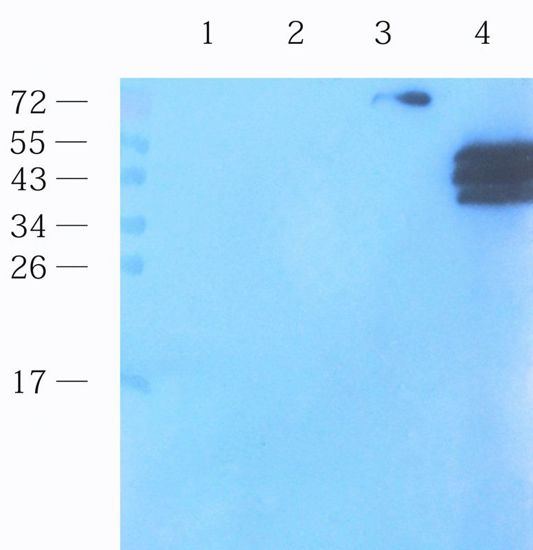 Interferon gamma antibody