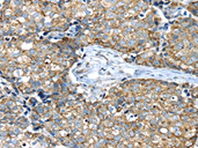 IFNA2 antibody