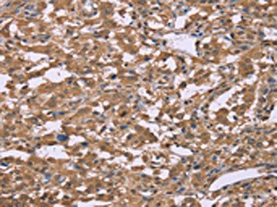 IFNA2 antibody