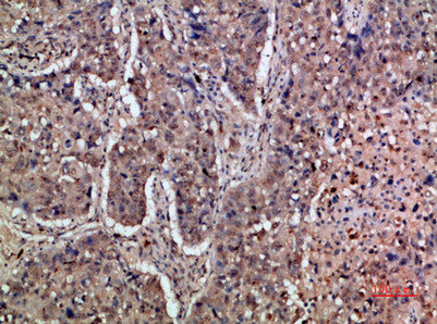 IFNAR1 antibody