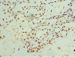 IFNGR1 Antibody