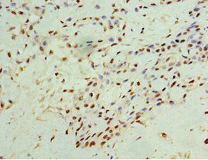 IFNGR1 antibody