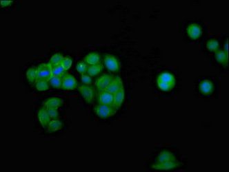 IFNGR2 Antibody