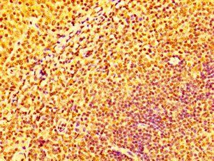 IFNGR2 Antibody