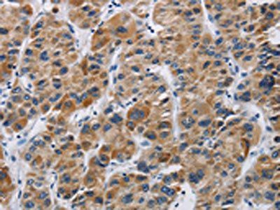 IFNGR2 antibody